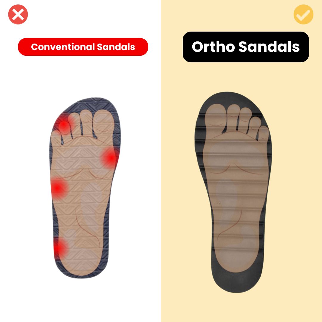 Orthofit™ Sandals - Woman's Ultra-Comfy sandals